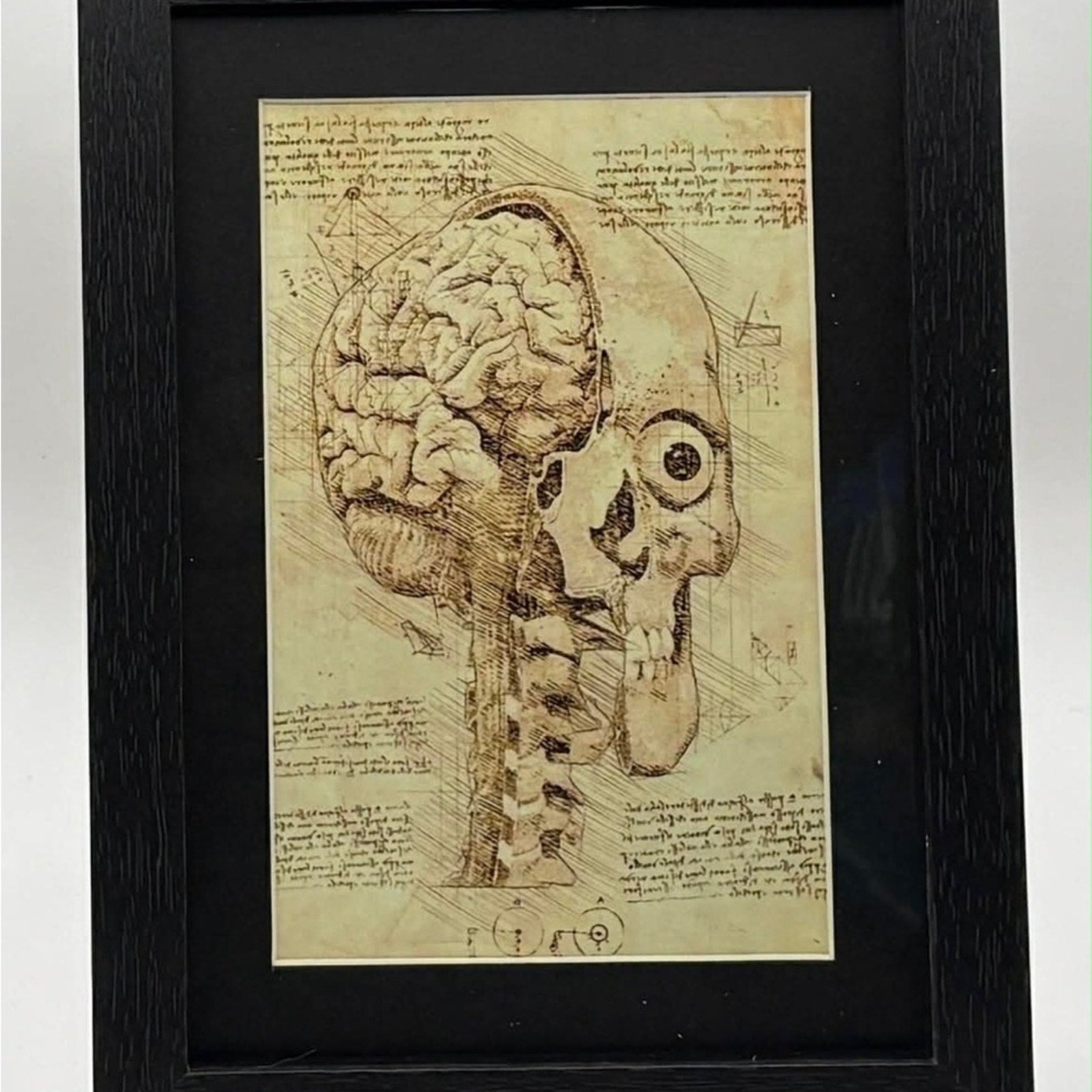 🧠🖤 Anatomical Skull & Brain Art – Framed Dark Academia Wall Décor